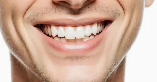 Branqueamento Dentário
