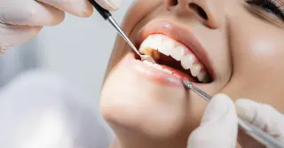 Contorno Dental com Resina