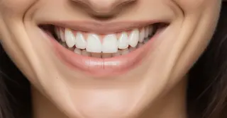 Facetas nos Dentes Preço