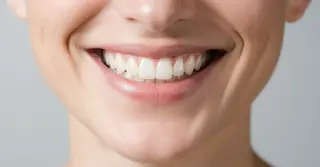 Fechamento de Diastemas