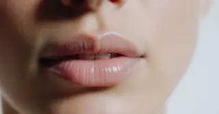 Preenchimento Labial