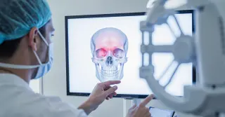 Reconstrução Óssea para Implantes