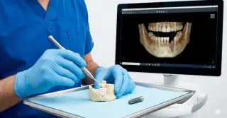 Remodelagem Óssea para Próteses