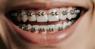 Tratamento Ortodôntico